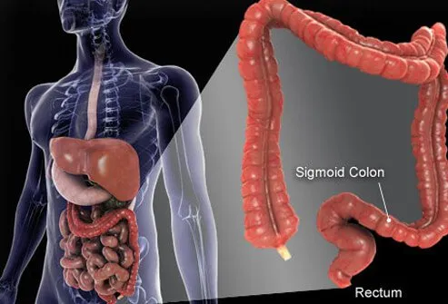 colon cancer screening